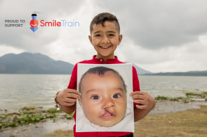 Image showing before and after the life changing operation.